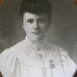 MaThiLdE LeMoNNieR - Dentellite aigüe 
